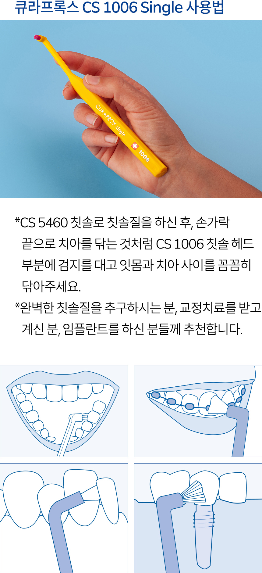 큐라프록스 CS 1006 Single 사용법. CS 5460 칫솔로 칫솔질을 하신 후, 손가락 끝으로 치아를 닦는 것처럼 CS 1006 칫솔 헤드 부분에 검지를 대고 잇몸과 치아 사이를 꼼꼼히 닦아주세요. 완벽한 칫솔질을 추구하시는 분, 교정치료를 받고 계신 분, 임플란트를 하신 분들께 추천합니다.